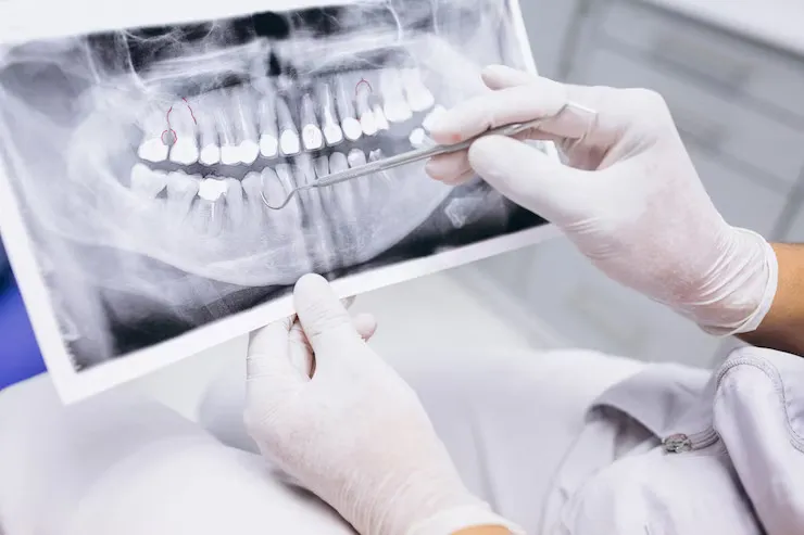 رشته دندانپزشکی در ترکیه